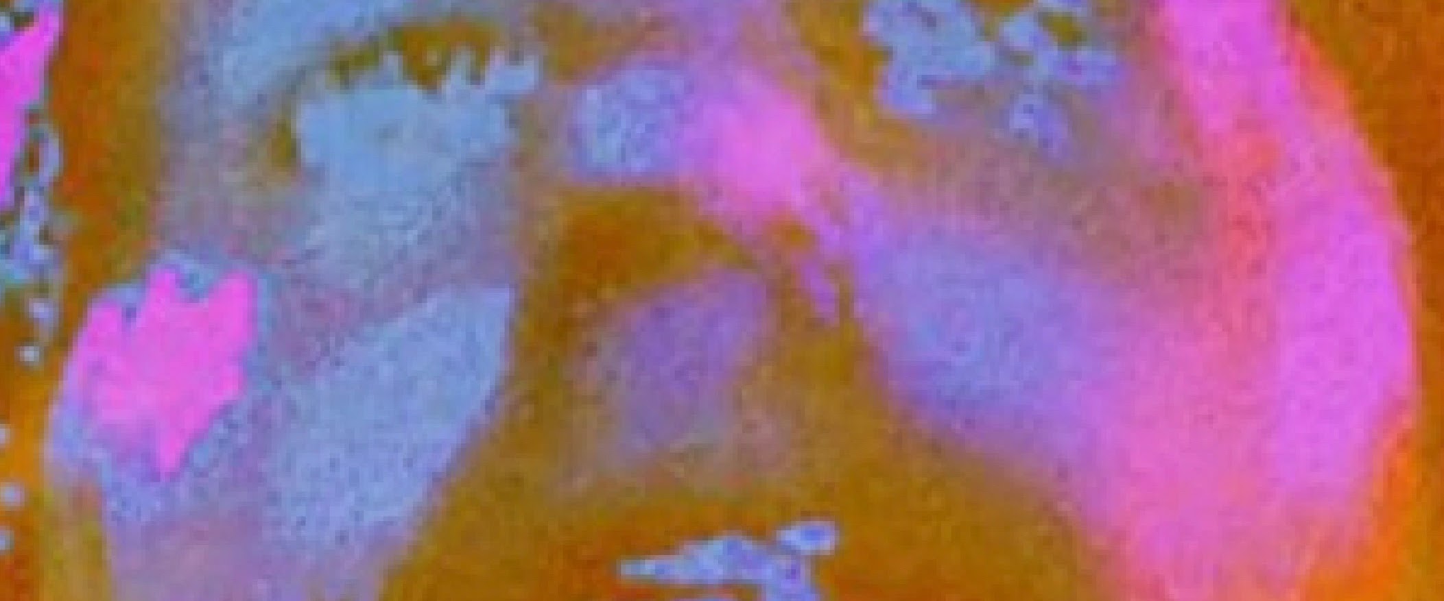 Bilmuri